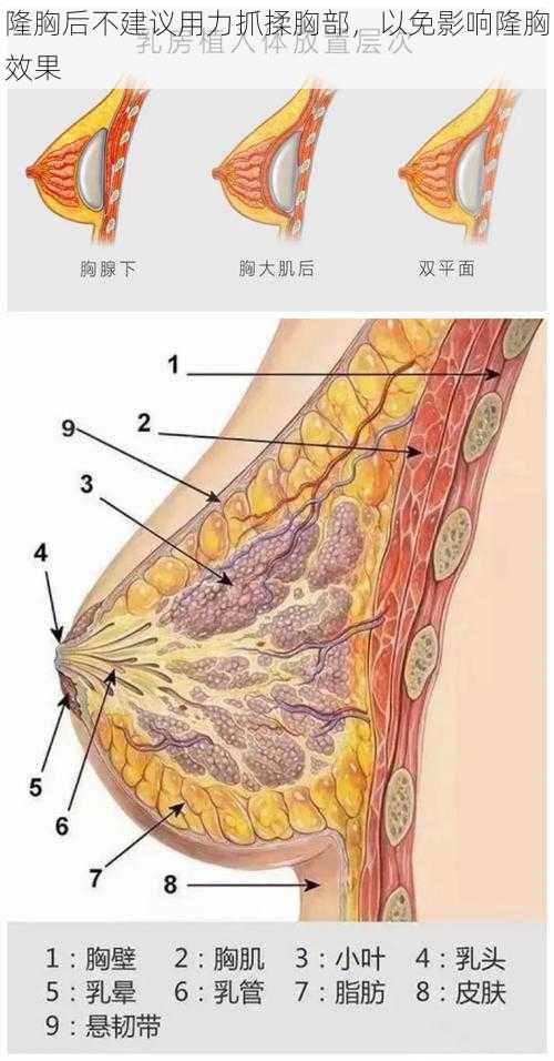 隆胸后不建议用力抓揉胸部，以免影响隆胸效果