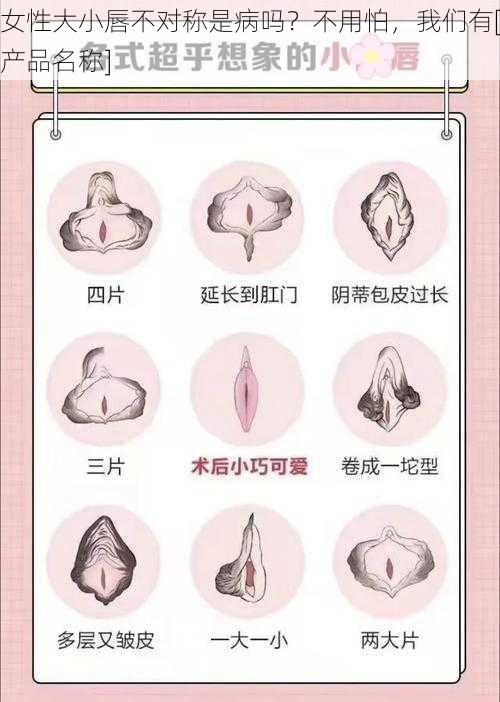 女性大小唇不对称是病吗？不用怕，我们有[产品名称]